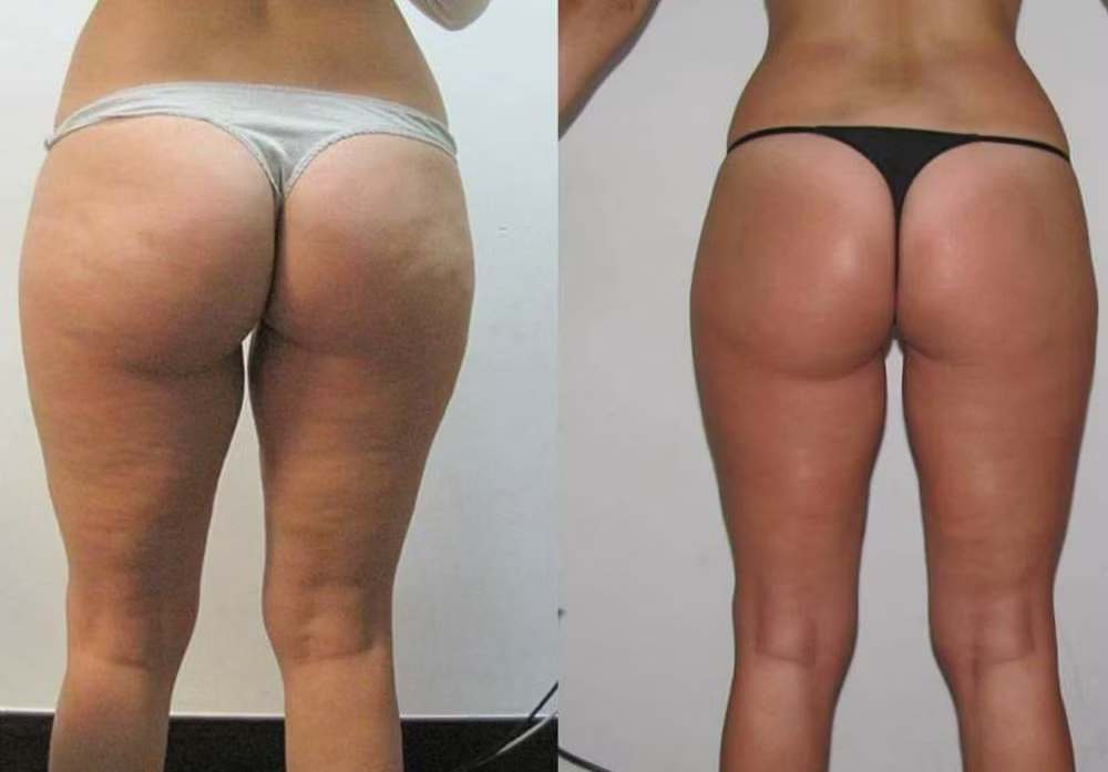 10 seances - silhouette